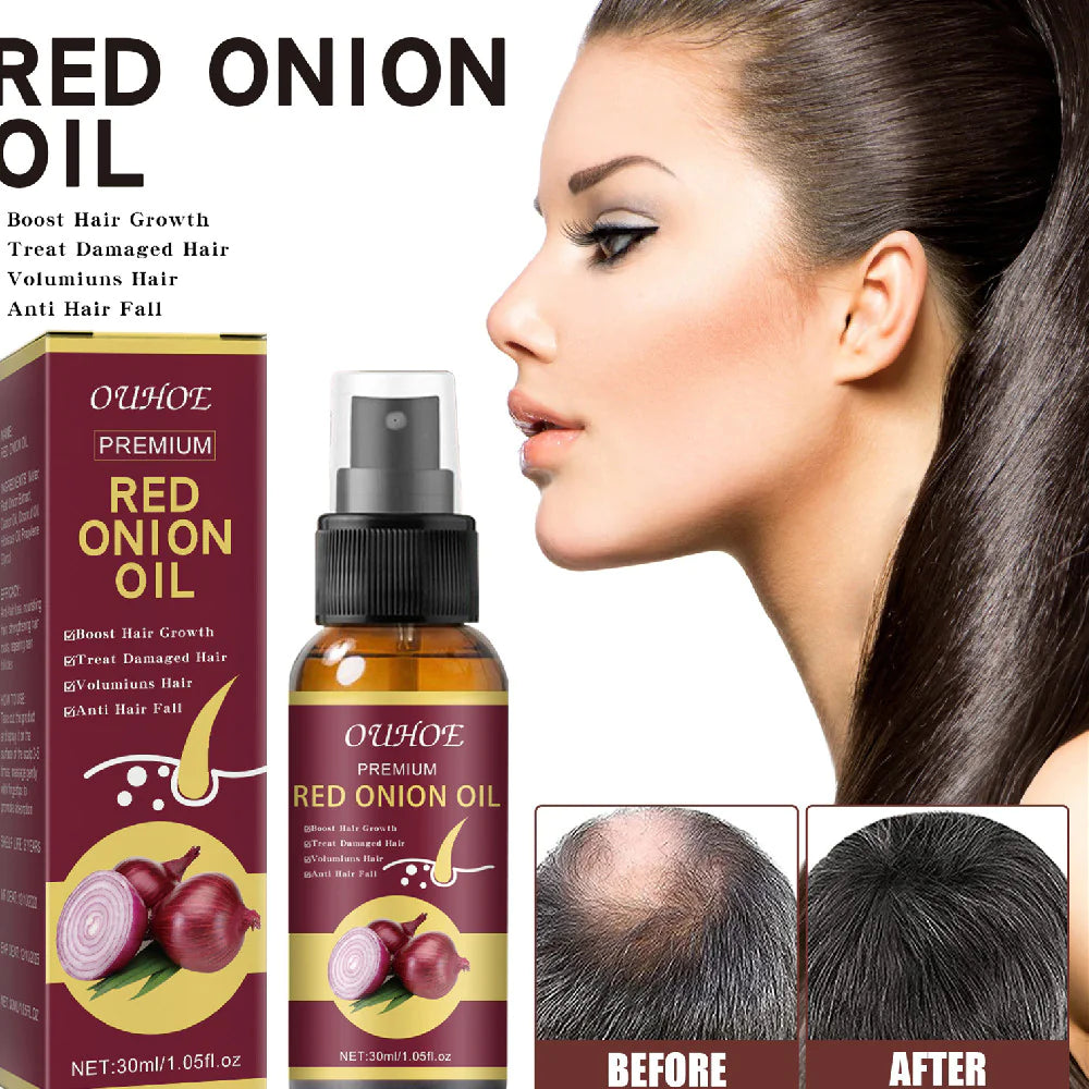 Natural Red Onion Hair Growth Oil Spray